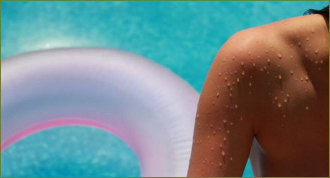 Razina zaštite od sunca trebala bi biti optimalna za kožu